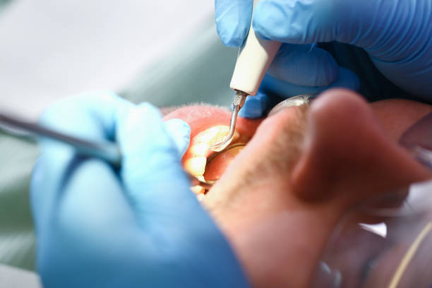 Best Broken or Cracked Tooth Emergency Dentist in Dunsmuir, CA
